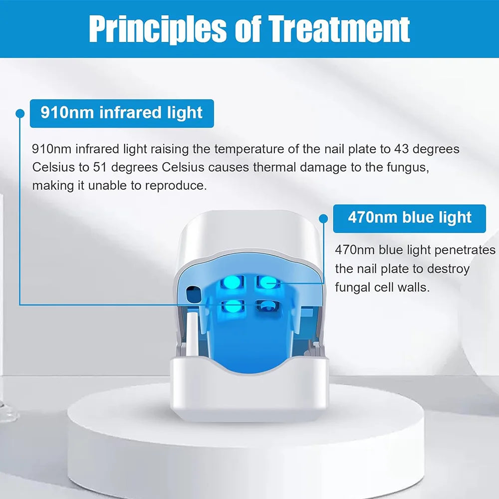 Laser Treatment for Nail Fungus